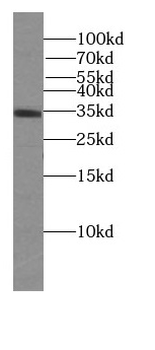 MYCL Antibody