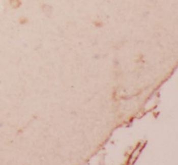 MYH10 Antibody