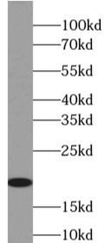 MZB1 Rabbit Polyclonal Antibody
