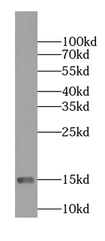 NDUFS5 Mouse Monoclonal Antibody