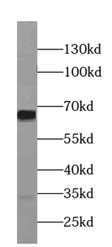 NELFB Rabbit Polyclonal Antibody