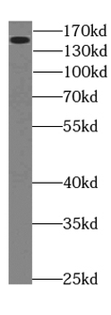 NEFM Specific Rabbit Polyclonal Antibody