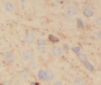 NEFM Specific Rabbit Polyclonal Antibody