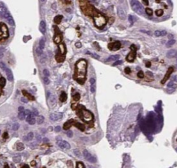 NUTF2 Mouse Monoclonal Antibody