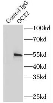 POU2F2 Rabbit Polyclonal Antibody