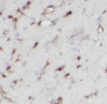 TENM1 Rabbit Polyclonal Antibody