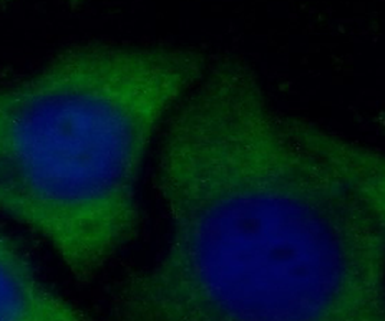 ORM2 Specific Mouse Monoclonal Antibody