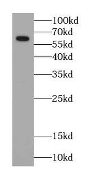 P4HA1 Mouse Monoclonal Antibody