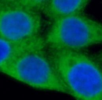 P4HA1 Mouse Monoclonal Antibody