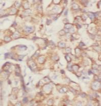 P4HA1 Mouse Monoclonal Antibody