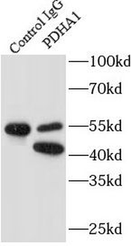 PDHA1 Mouse Monoclonal Antibody