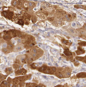 PDHA1 Mouse Monoclonal Antibody