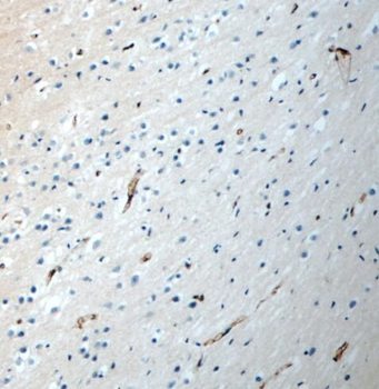 PEX5L Rabbit Polyclonal Antibody