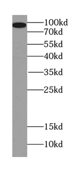 PGAP1 Antibody