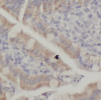 PGM1 Mouse Monoclonal Antibody