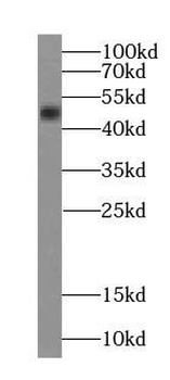 phospho TDP43 (409/410) Rabbit Polyclonal Antibody