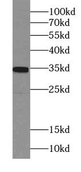 PHOX2B Mouse Monoclonal Antibody