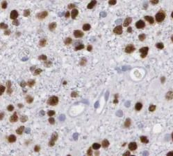 PHOX2B Mouse Monoclonal Antibody