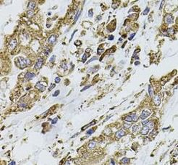 PIK3CA Rabbit Polyclonal Antibody