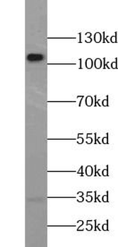 PIK3CA Rabbit Polyclonal Antibody