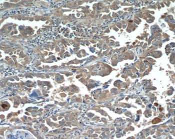 PIK3CA Rabbit Polyclonal Antibody