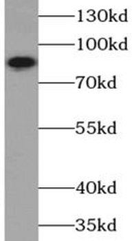 PIK3R1 Mouse Monoclonal Antibody