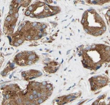 PIK3R1 Mouse Monoclonal Antibody