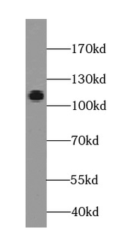 EGFLAM Mouse Monoclonal Antibody