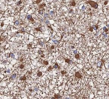 PKM1 Antibody