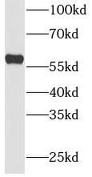 PKM2 Antibody