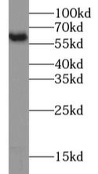 PKM2 specific Mouse Monoclonal Antibody