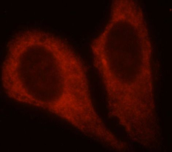 PKM2 specific Mouse Monoclonal Antibody
