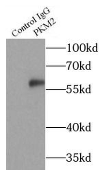 PKM2 specific Mouse Monoclonal Antibody