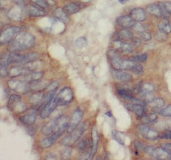 PKM2 specific Mouse Monoclonal Antibody