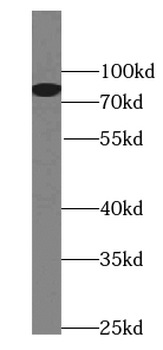PLAA Mouse Monoclonal Antibody