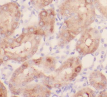 PLAA Mouse Monoclonal Antibody