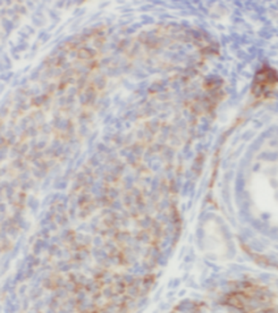 POTEA Specific Rabbit Polyclonal Antibody