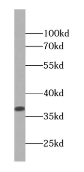 PPP1CB Specific Rabbit Polyclonal Antibody