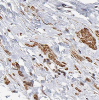 PPP1CB Specific Rabbit Polyclonal Antibody