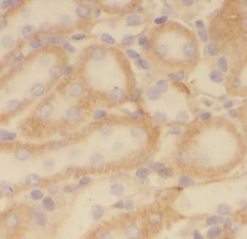 PRDX5 Rabbit Polyclonal Antibody