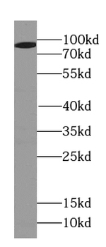 PSD2 Rabbit Polyclonal Antibody