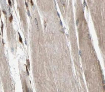 PYGM Specific Rabbit Polyclonal Antibody
