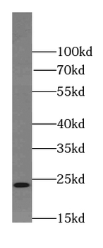 RAB11B Rabbit Polyclonal Antibody