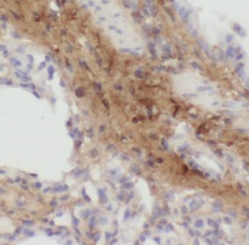 RAB11B Rabbit Polyclonal Antibody