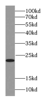 RAB18 Mouse Monoclonal Antibody