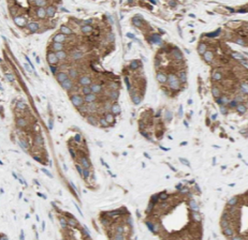 RAB18 Mouse Monoclonal Antibody