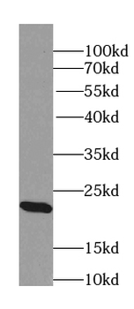 RAB22A specific Rabbit Polyclonal Antibody