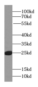 RAB27A Specific Rabbit Polyclonal Antibody