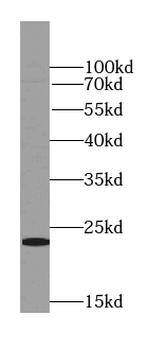 RAB31 specific Rabbit Polyclonal Antibody