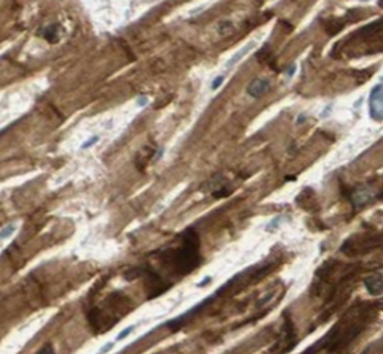 RAB31 specific Rabbit Polyclonal Antibody
